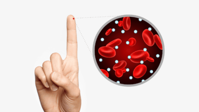 My 7-Pillar Strategy for Lowering HbA1c Levels in Diabetics